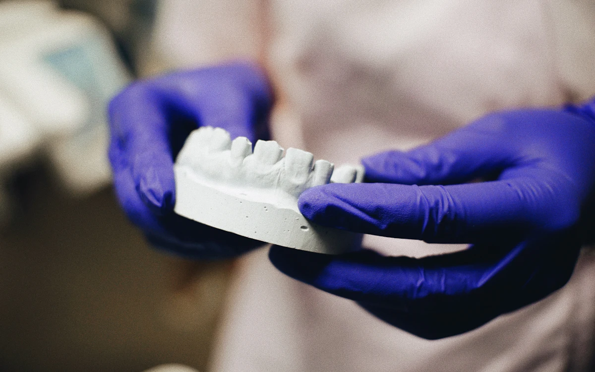 Mãos com luva azul segurando um modelo dentário impresso em resina